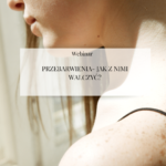 Webinar "Przebarwienia- jak z nimi walczyć?"